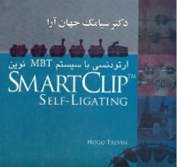 ارتودنسی با سیستم MBT نوین SMART CLIP TM