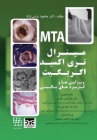 مینرال تری اکسید اگریگیت ویژگی ها و کاربردهای بالینی (MTA)