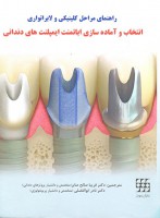 راهنمای مراحل کلینیکی و لابراتواری انتخاب و آماده‌سازی اباتمنت ایمپلنت‌های دندانی
