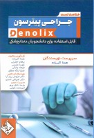 خلاصه تست جراحی پیترسون denolix