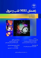 راهنمای MRI قلب و عروق