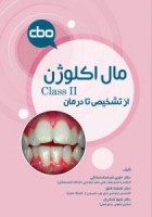 مال اکلوژن Class II – از تشخیص تا درمان