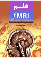 علم MRI