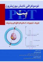 توموگرافی تابش پوزیترون (پت)