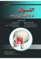 اکلوژن در دندانپزشکی ایمپلنت